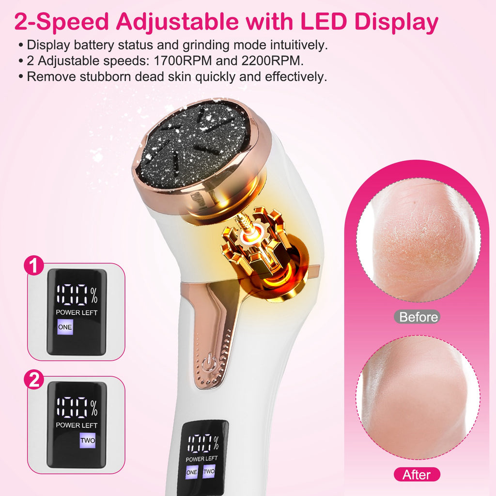 17Pcs Electric Foot Callus Remover With Vacuum Foot Grinder Rechargeable Foot File Dead Skin Pedicure Machine With 3 Grinding Heads 2 Speeds Foot Care Tool